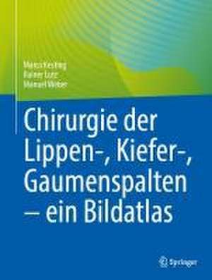 Chirurgie der Lippen-, Kiefer-, Gaumenspalten – ein Bildatlas de Marco Kesting