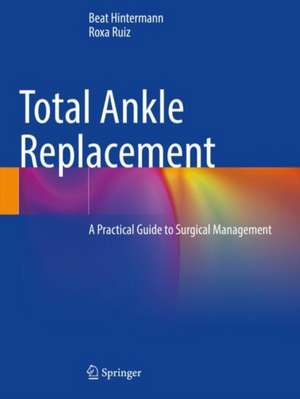 Total Ankle Replacement de Beat Hintermann