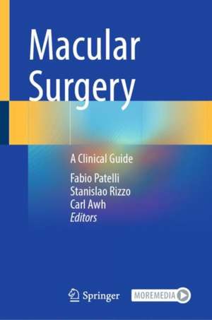 Macular Surgery: A Clinical Guide de Fabio Patelli