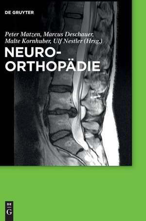 Neuroorthopädie de Peter Matzen