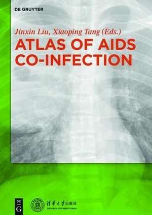 Atlas of AIDS Co-infection de Jinxin Liu