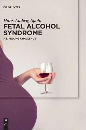 Fetal Alcohol Syndrome: In Childhood and Adulthood de Hans-Ludwig Spohr