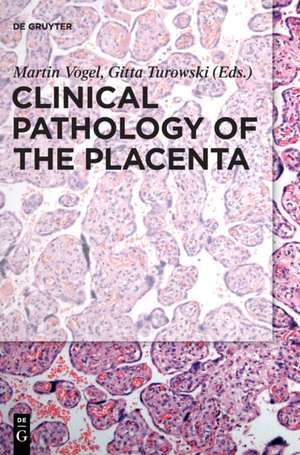 Clinical Pathology of the Placenta de Martin Vogel