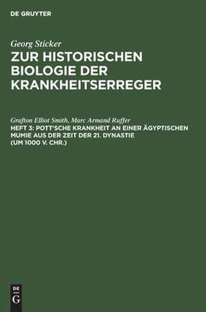 Pott'sche Krankheit an einer ägyptischen Mumie aus der Zeit der 21. Dynastie (um 1000 v. Chr.) de Grafton Elliot Smith