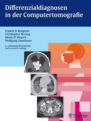 Differenzialdiagnosen in der Computertomografie