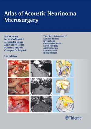 Atlas of Acoustic Neurinoma Microsurgery de Mario Sanna