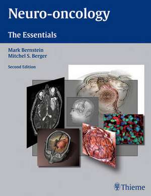 Neuro-oncology: The Essentials