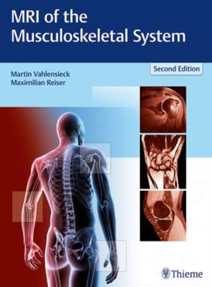 MRI of the Musculoskeletal System de Martin Vahlensieck