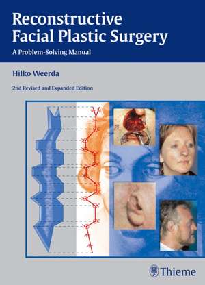 Reconstructive Facial Plastic Surgery – A Problem–Solving Manual de Hilko Weerda