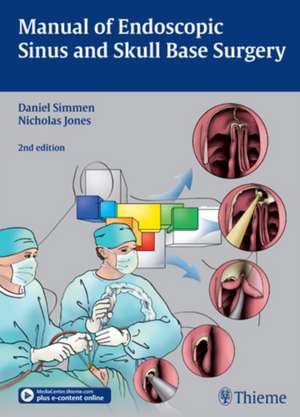 Manual of Endoscopic Sinus and Skull Base Surgery de Daniel Simmen