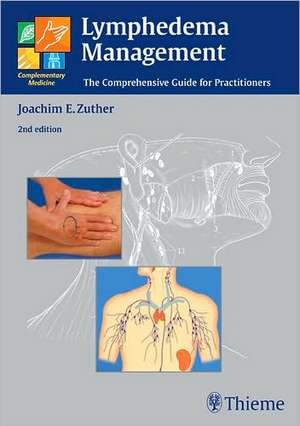 Lymphedema Management: The Comprehensive Guide for Practitioners de Joachim Ernst Zuther