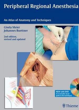 Peripheral Regional Anesthesia: An Atlas of Anatomy and Techniques de Gisela Meier