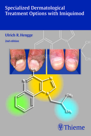 Specialized Dermatological Treatment Options with Imiquimod de R. Ulrich Hengge