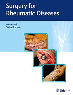 Surgery for Rheumatic Diseases de Stefan Sell