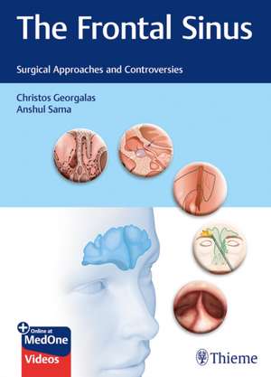 The Frontal Sinus – Surgical Approaches and Controversies: Surgical Approaches and Controversies de Christos Georgalas