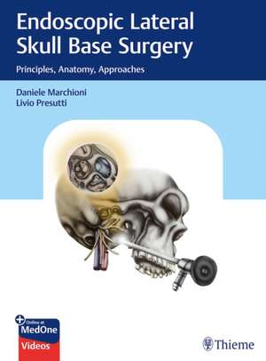 Endoscopic Lateral Skull Base Surgery – Principles, Anatomy, Approaches de Daniele Marchioni