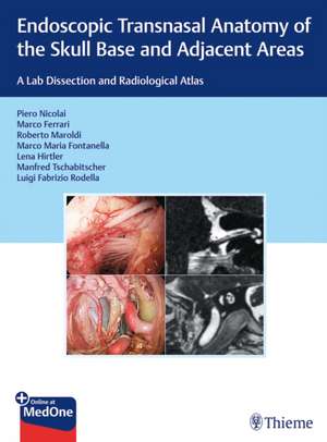 Endoscopic Transnasal Anatomy of the Skull Base – A Lab Dissection and Radiological Atlas de Piero Nicolai