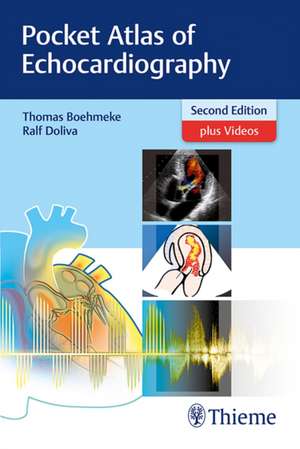 Pocket Atlas of Echocardiography de Thomas Böhmeke