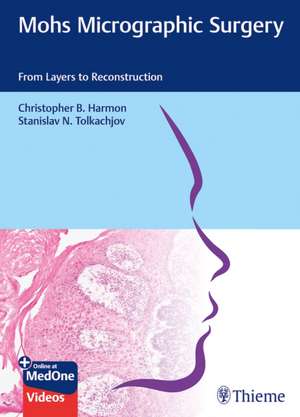 Mohs Micrographic Surgery: From Layers to Reconstruction de Christopher B. Harmon