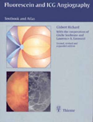 Fluorescein and ICG Angiography de Gisbert Richard