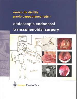 Endoscopic Endonasal Transsphenoidal Surgery de Enrico de Divitiis