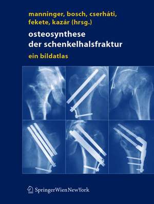 Osteosynthese der Schenkelhalsfraktur: Ein Bildatlas de Jenö Manninger