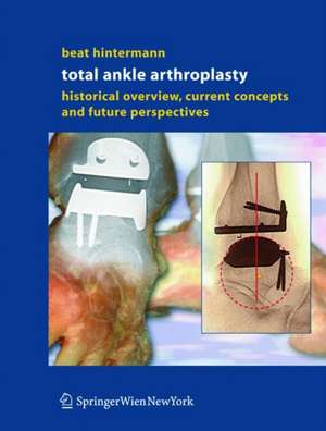 Total Ankle Arthroplasty: Historical Overview, Current Concepts and Future Perspectives de Beat Hintermann