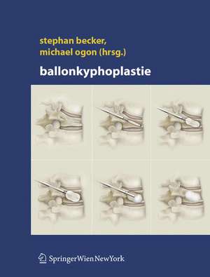 Ballonkyphoplastie de Stephan Becker