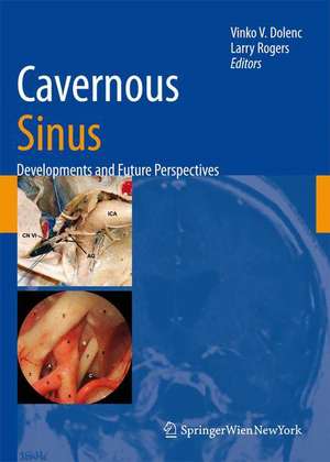 Cavernous Sinus: Developments and Future Perspectives de Vinko V. Dolenc