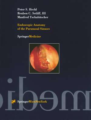 Endoscopic Anatomy of the Paranasal Sinuses de Peter S. Hechl