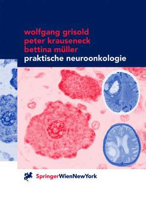 Praktische Neuroonkologie de Wolfgang Grisold