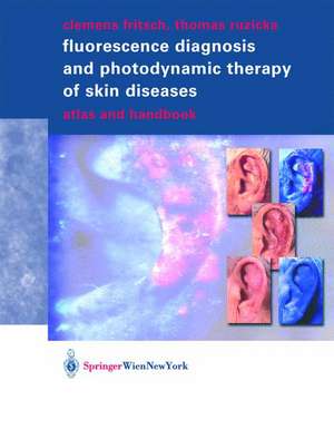 Fluorescence Diagnosis and Photodynamic Therapy of Skin Diseases: Atlas and Handbook de Clemens Fritsch