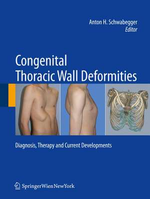 Congenital Thoracic Wall Deformities: Diagnosis, Therapy and Current Developments de Anton H. Schwabegger