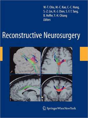 Reconstructive Neurosurgery de Wen-Ta Chiu