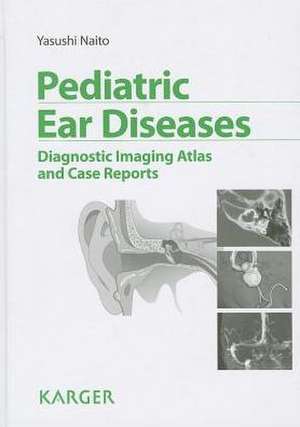 Pediatric Ear Diseases de Yasushi Naito