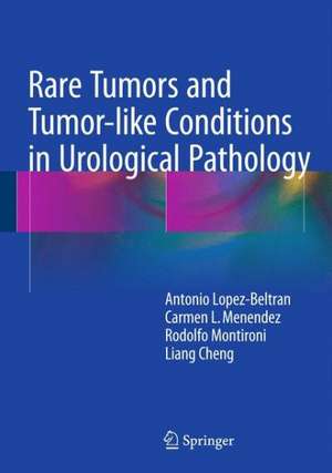 Rare Tumors and Tumor-like Conditions in Urological Pathology de Antonio Lopez-Beltran