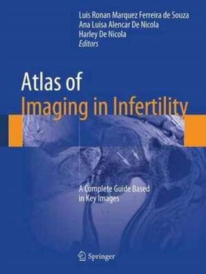 Atlas of Imaging in Infertility: A Complete Guide Based in Key Images de Luis Ronan Marquez Ferreira de Souza