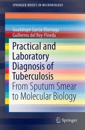 Practical and Laboratory Diagnosis of Tuberculosis: From Sputum Smear to Molecular Biology de Guadalupe García-Elorriaga