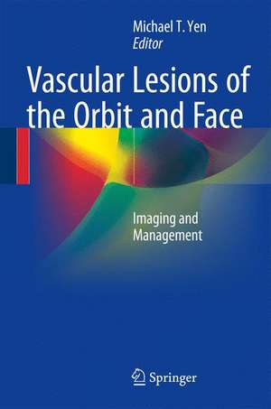 Vascular Lesions of the Orbit and Face: Imaging and Management de Michael T. Yen