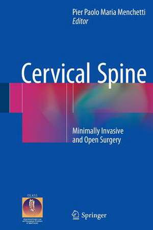 Cervical Spine: Minimally Invasive and Open Surgery de Pier Paolo Maria Menchetti