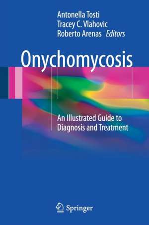 Onychomycosis: An Illustrated Guide to Diagnosis and Treatment de Antonella Tosti