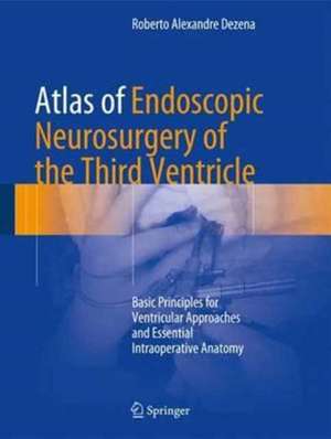 Atlas of Endoscopic Neurosurgery of the Third Ventricle: Basic Principles for Ventricular Approaches and Essential Intraoperative Anatomy de Roberto Alexandre Dezena