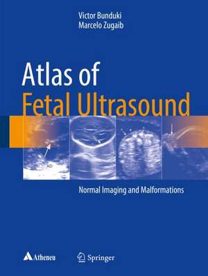 Atlas of Fetal Ultrasound: Normal Imaging and Malformations de Victor Bunduki