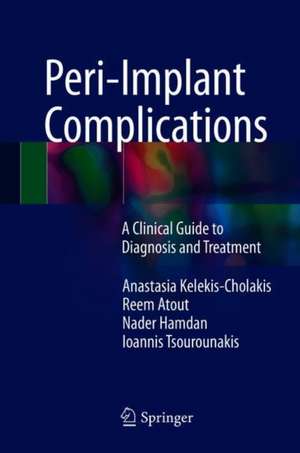 Peri-Implant Complications: A Clinical Guide to Diagnosis and Treatment de Anastasia Kelekis-Cholakis