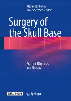 Surgery of the Skull Base: Practical Diagnosis and Therapy de Alexander König