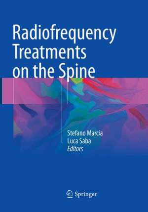 Radiofrequency Treatments on the Spine de Stefano Marcia