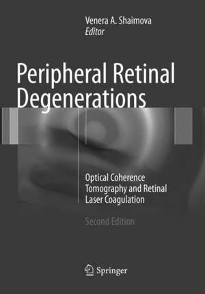 Peripheral Retinal Degenerations: Optical Coherence Tomography and Retinal Laser Coagulation de Venera A. Shaimova