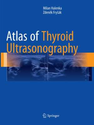 Atlas of Thyroid Ultrasonography de Milan Halenka