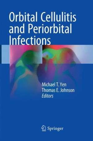 Orbital Cellulitis and Periorbital Infections de Michael T. Yen