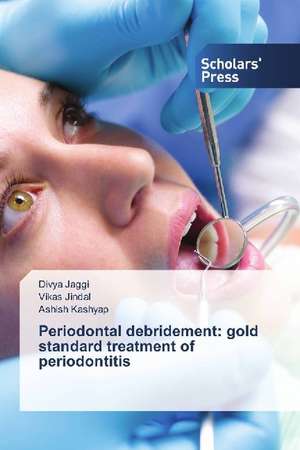 Periodontal debridement: gold standard treatment of periodontitis de Divya Jaggi